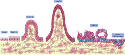 Can Nimesulide Nanoparticles Be a Therapeutic Strategy for the Inhibition of the KRAS/PTEN Signaling Pathway in Pancreatic Cancer?